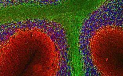 Immunocytochemistry/ Immunofluorescence: alpha-Internexin Antibody [NB110-93355]