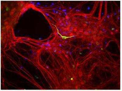 Immunocytochemistry/ Immunofluorescence: alpha-Internexin Antibody [NB300-139]