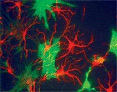 Immunocytochemistry/ Immunofluorescence: alpha-Internexin Antibody [NB300-139]