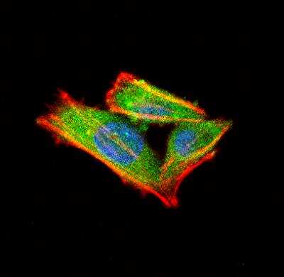 Immunocytochemistry/ Immunofluorescence: alpha-Internexin Antibody [NB300-139]