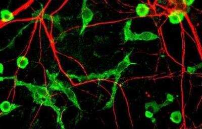 Immunocytochemistry/ Immunofluorescence: alpha-Internexin Antibody [NBP1-05208]