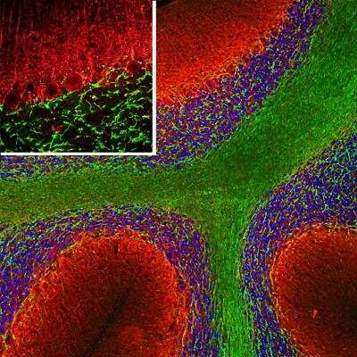 Immunohistochemistry Free-Floating: alpha-Internexin Antibody [NBP1-05208]