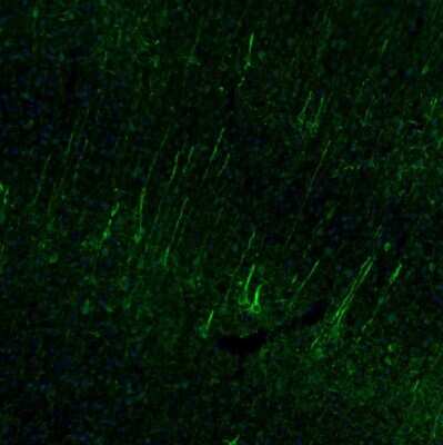 Immunohistochemistry-Paraffin: alpha-Internexin Antibody [NBP1-81007]