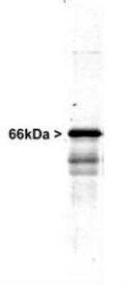 Western Blot: alpha-Internexin Antibody [NB300-139]