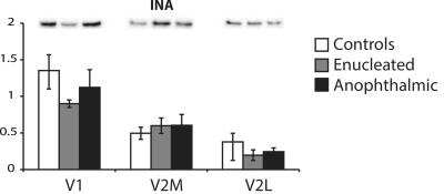 Western Blot: alpha-Internexin Antibody [NB300-139]