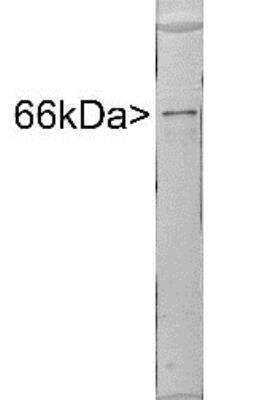 Western Blot: alpha-Internexin Antibody [NBP1-05208]