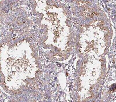 Immunohistochemistry-Paraffin: alpha-L-Iduronidase/IDUA Antibody [NBP2-48863]