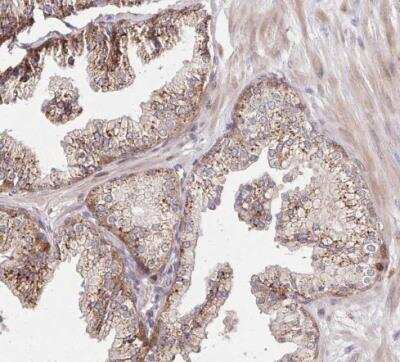 Immunohistochemistry-Paraffin: alpha-L-Iduronidase/IDUA Antibody [NBP2-48863]