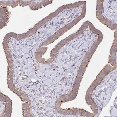 Immunohistochemistry-Paraffin: alpha-L-Iduronidase/IDUA Antibody [NBP2-48863]