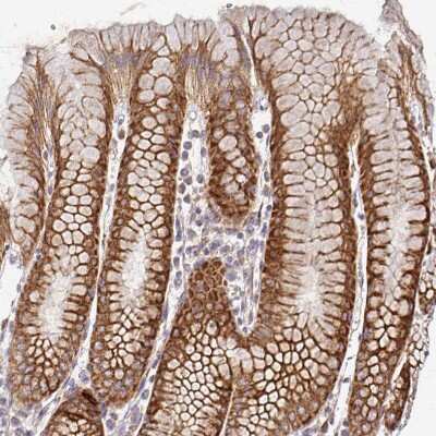 Immunohistochemistry-Paraffin: alpha-L-Iduronidase/IDUA Antibody [NBP2-49126]