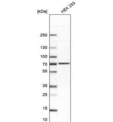 Western Blot: alpha-L-Iduronidase/IDUA Antibody [NBP2-48863]