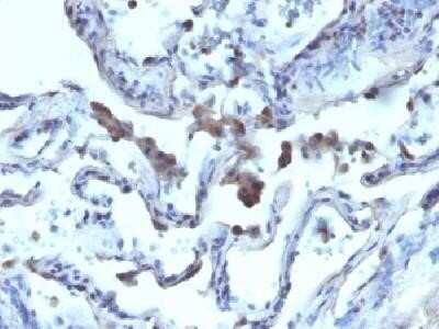 Immunohistochemistry-Paraffin: alpha-Methylacyl-CoA Racemase/AMACR Antibody - Azide and BSA Free [NBP2-34514]