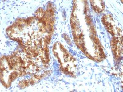 Immunohistochemistry-Paraffin: alpha-Methylacyl-CoA Racemase/AMACR Antibody - IHC-Prediluted [NBP2-48130]