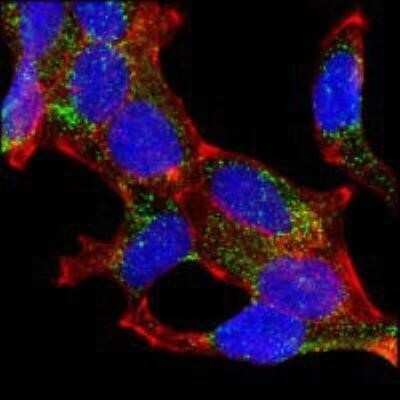 Immunocytochemistry/ Immunofluorescence: alpha-Methylacyl-CoA Racemase/AMACR Antibody (2A10F3) - BSA Free [NBP1-28884]