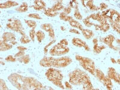 Immunohistochemistry-Paraffin: alpha-Methylacyl-CoA Racemase/AMACR Antibody (AMACR/1723) - Azide and BSA Free [NBP2-54501]