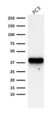 Western Blot: alpha-Methylacyl-CoA Racemase/AMACR Antibody (AMACR/1723)Azide and BSA Free [NBP2-54501]