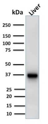 Western Blot: alpha-Methylacyl-CoA Racemase/AMACR Antibody (AMACR/1723) [NBP2-53390]