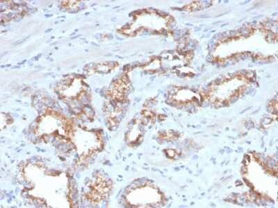 Immunohistochemistry-Paraffin: alpha-Methylacyl-CoA Racemase/AMACR Antibody (AMACR/4572R) [NBP3-07592]