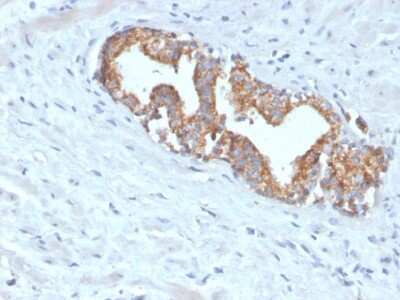 Immunohistochemistry-Paraffin: alpha-Methylacyl-CoA Racemase/AMACR Antibody (AMACR/4572R) [NBP3-07592]