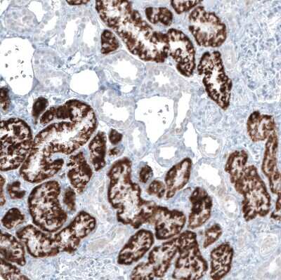 Immunohistochemistry-Paraffin: alpha-Methylacyl-CoA Racemase/AMACR Antibody (CL9360) [NBP2-88930]