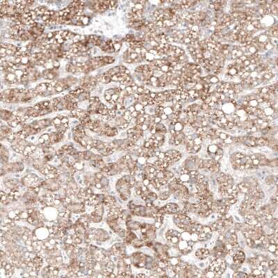 Immunohistochemistry-Paraffin: alpha-Methylacyl-CoA Racemase/AMACR Antibody (CL9360) [NBP2-88930]