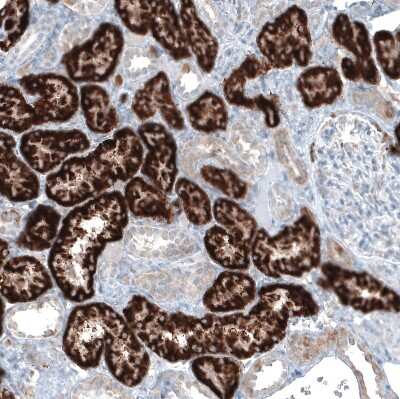 Immunohistochemistry-Paraffin: alpha-Methylacyl-CoA Racemase/AMACR Antibody (CL9362) [NBP2-88931]