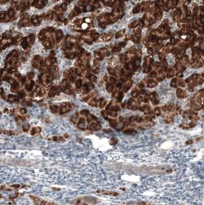 Immunohistochemistry-Paraffin: alpha-Methylacyl-CoA Racemase/AMACR Antibody (CL9362) [NBP2-88931]