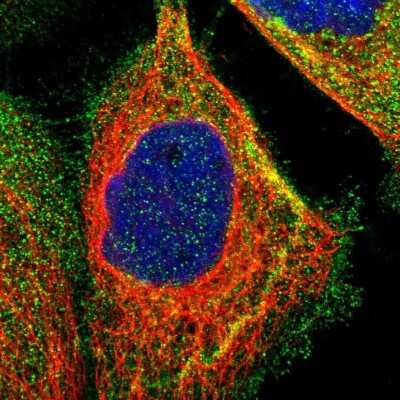 Immunocytochemistry/ Immunofluorescence: alpha-Methylacyl-CoA Racemase/AMACR Antibody [NBP1-87168]