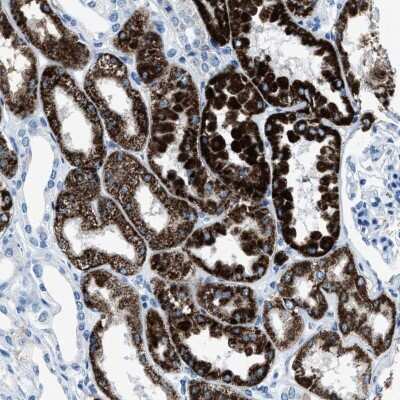 Immunohistochemistry-Paraffin: alpha-Methylacyl-CoA Racemase/AMACR Antibody [NBP1-87168]