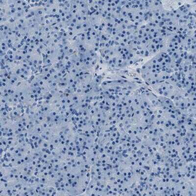 Immunohistochemistry-Paraffin: alpha-Methylacyl-CoA Racemase/AMACR Antibody [NBP1-87168]