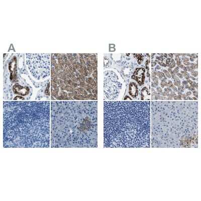 Immunohistochemistry-Paraffin: alpha-Methylacyl-CoA Racemase/AMACR Antibody [NBP1-87168]