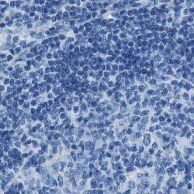 Immunohistochemistry-Paraffin: alpha-Methylacyl-CoA Racemase/AMACR Antibody [NBP1-87168]