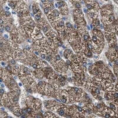 Immunohistochemistry-Paraffin: alpha-Methylacyl-CoA Racemase/AMACR Antibody [NBP1-87168]