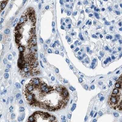 Immunohistochemistry-Paraffin: alpha-Methylacyl-CoA Racemase/AMACR Antibody [NBP1-87168]