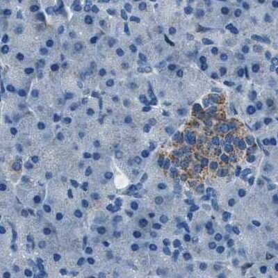 Immunohistochemistry-Paraffin: alpha-Methylacyl-CoA Racemase/AMACR Antibody [NBP1-87168]