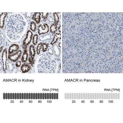 Immunohistochemistry-Paraffin: alpha-Methylacyl-CoA Racemase/AMACR Antibody [NBP1-87169]