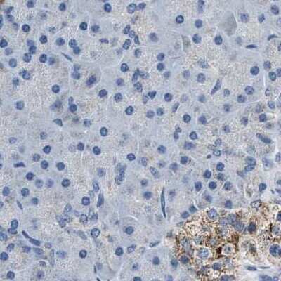 Immunohistochemistry-Paraffin: alpha-Methylacyl-CoA Racemase/AMACR Antibody [NBP1-87169]
