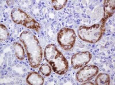 Immunohistochemistry: alpha-Methylacyl-CoA Racemase/AMACR Antibody (OTI5F10) - Azide and BSA Free [NBP2-71749]