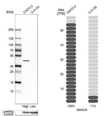 Western Blot: alpha-Methylacyl-CoA Racemase/AMACR Antibody [NBP1-87168]