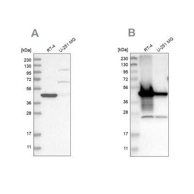 Western Blot: alpha-Methylacyl-CoA Racemase/AMACR Antibody [NBP1-87168]