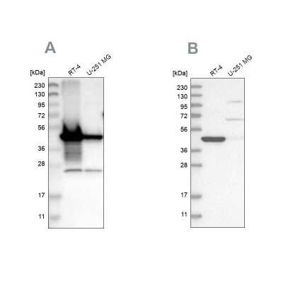 Western Blot: alpha-Methylacyl-CoA Racemase/AMACR Antibody [NBP1-87169]