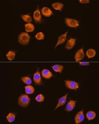 Immunocytochemistry/ Immunofluorescence: alpha-N-acetylgalactosaminidase/NAGA Antibody - BSA Free [NBP2-92593]