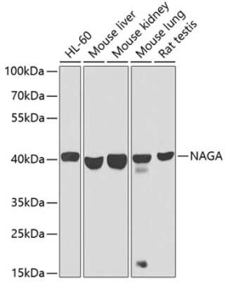 Western Blot: alpha-N-acetylgalactosaminidase/NAGA AntibodyBSA Free [NBP2-92593]