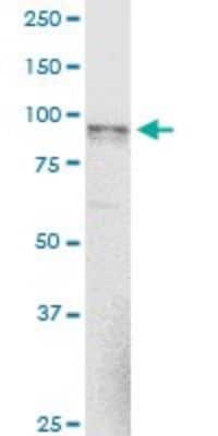Western Blot: alpha-N-acetylglucosaminidase/NAGLU Antibody (1B7) [H00004669-M02]