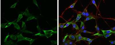 Immunocytochemistry/ Immunofluorescence: alpha-N-acetylglucosaminidase/NAGLU Antibody [NBP2-19465]
