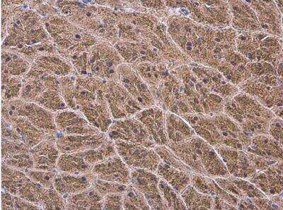 Immunohistochemistry-Paraffin: alpha-N-acetylglucosaminidase/NAGLU Antibody [NBP1-31555]