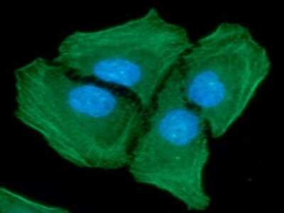 Immunocytochemistry/ Immunofluorescence: alpha-Smooth Muscle Actin Antibody (132D3) - BSA Free [NBP2-59429]