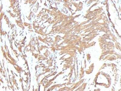 Immunohistochemistry-Paraffin: alpha-Smooth Muscle Actin Antibody (1A4 + ACTA2/791) [NBP2-44464]