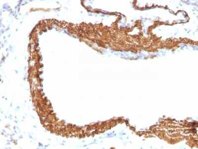 Immunohistochemistry-Paraffin: alpha-Smooth Muscle Actin Antibody (1A4 + ACTA2/791) [NBP2-44464]