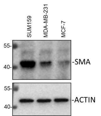 Western Blot Detection of alpha-Smooth Muscle Actin in Multiple Cell Lines